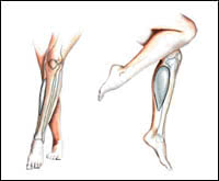 Leg correction in Israel